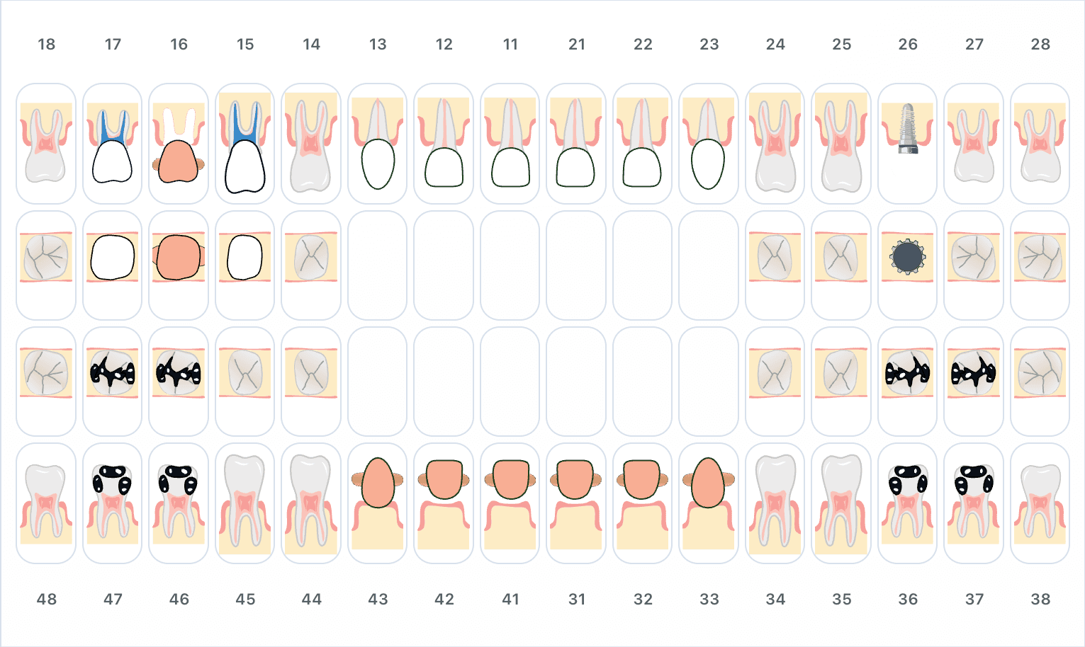Odontogramme dentaire interactif du logiciel NeoSmile avec les 32 dents en notation FDI
